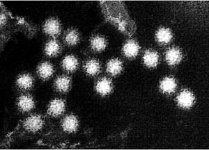 ノロウイルス（提供：北海道立衛生研究所）