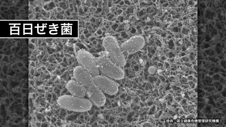 百日ぜき菌(提供:国立健康危機管理研究機構)