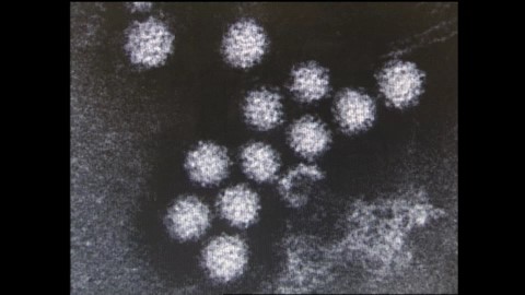 ノロウイルス【資料】