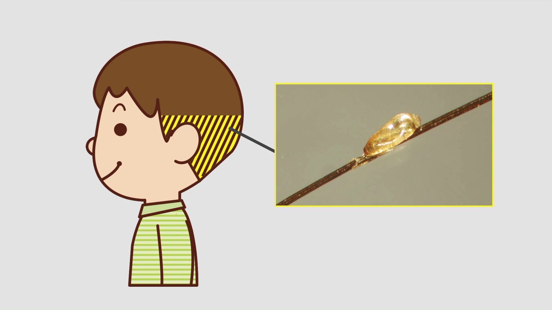 髪の毛の根元近くを要チェック