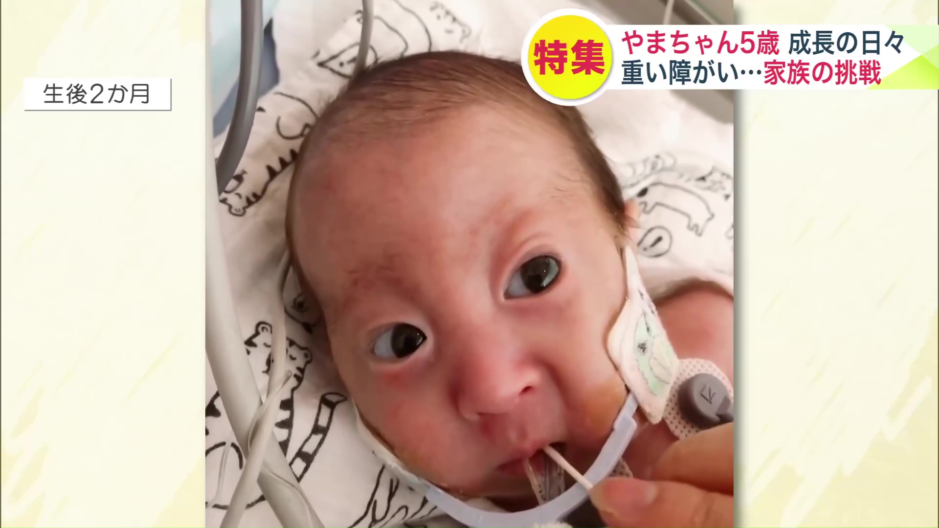 最初は綿棒でミルクを一滴ずつ