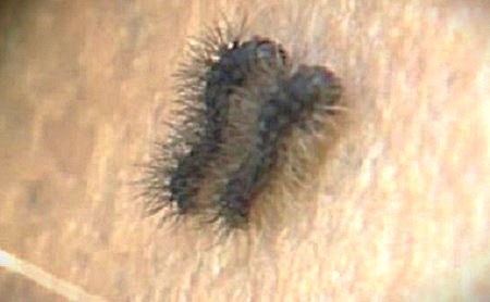 公園の遊具に発生したマイマイガの幼虫