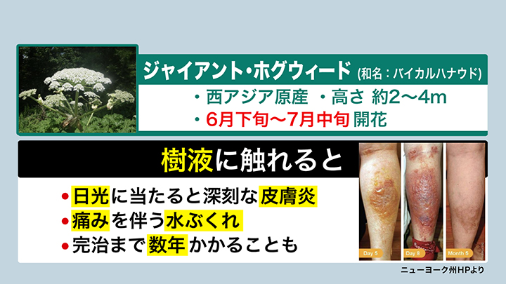 樹液に触れ日光に当たると、激しい皮膚炎などを引き起こす