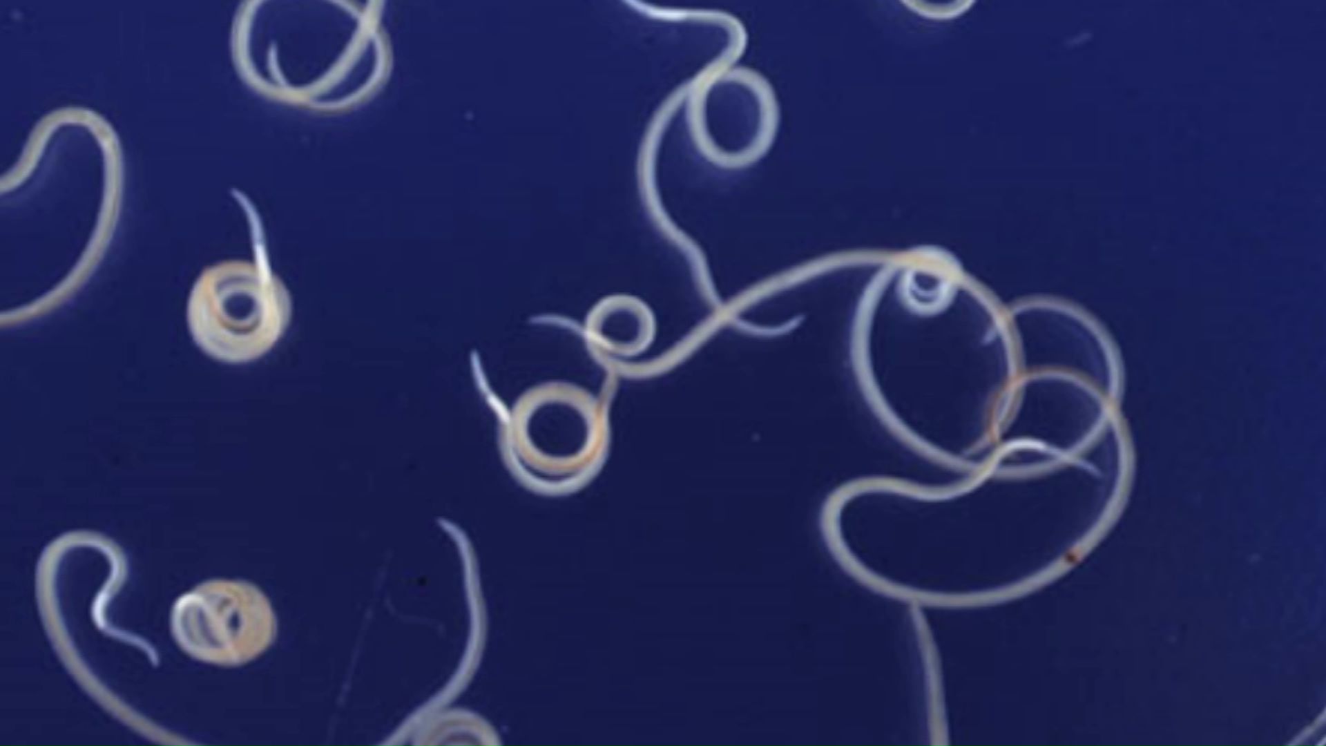 アニサキス（出典：国立健康危機管理研究機構 感染症情報提供サイト）