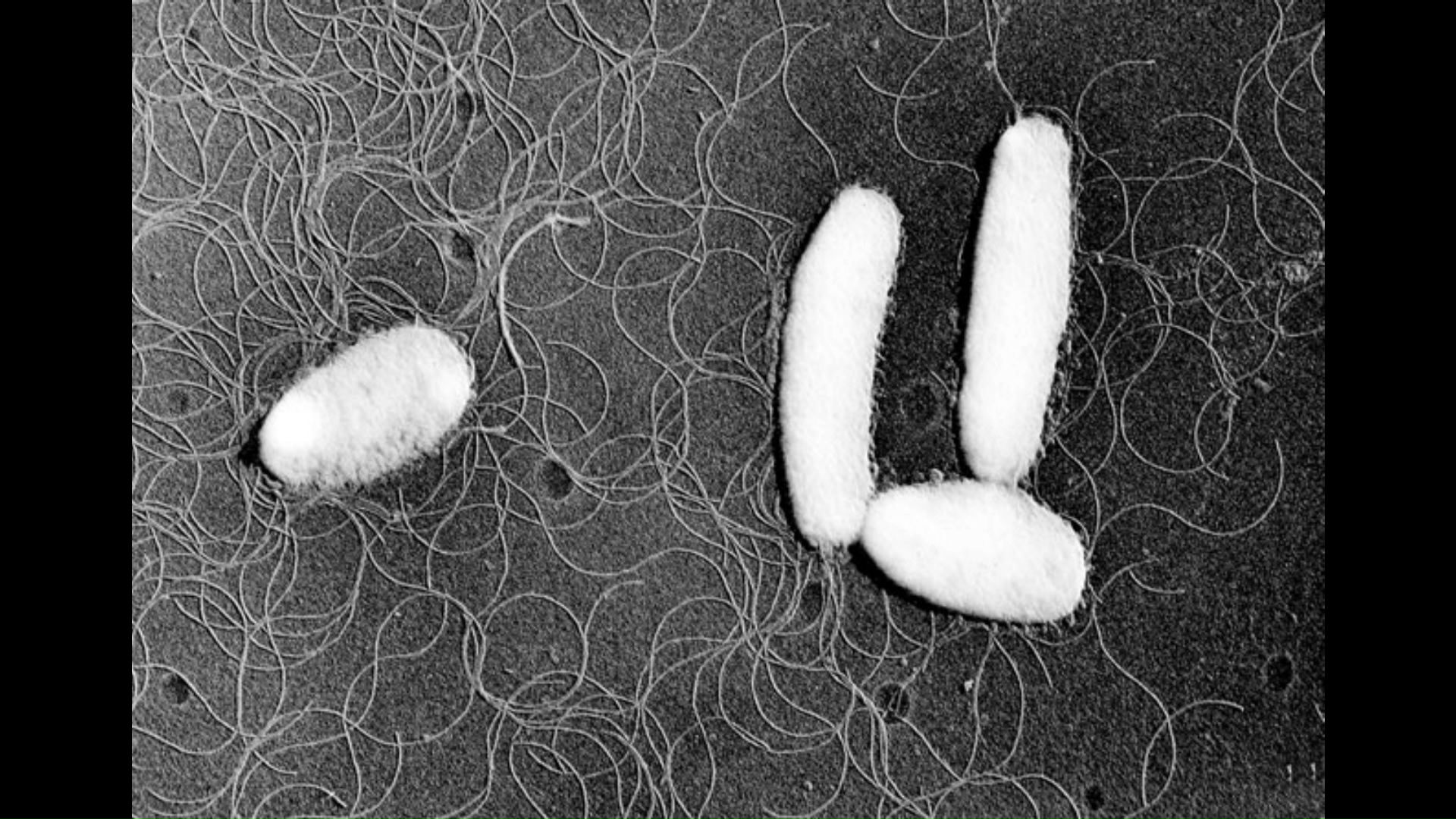 腸炎ビブリオ（提供：国立健康危機管理研究機構）
