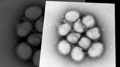 インフルエンザウイルス　提供 国立感染症研究所