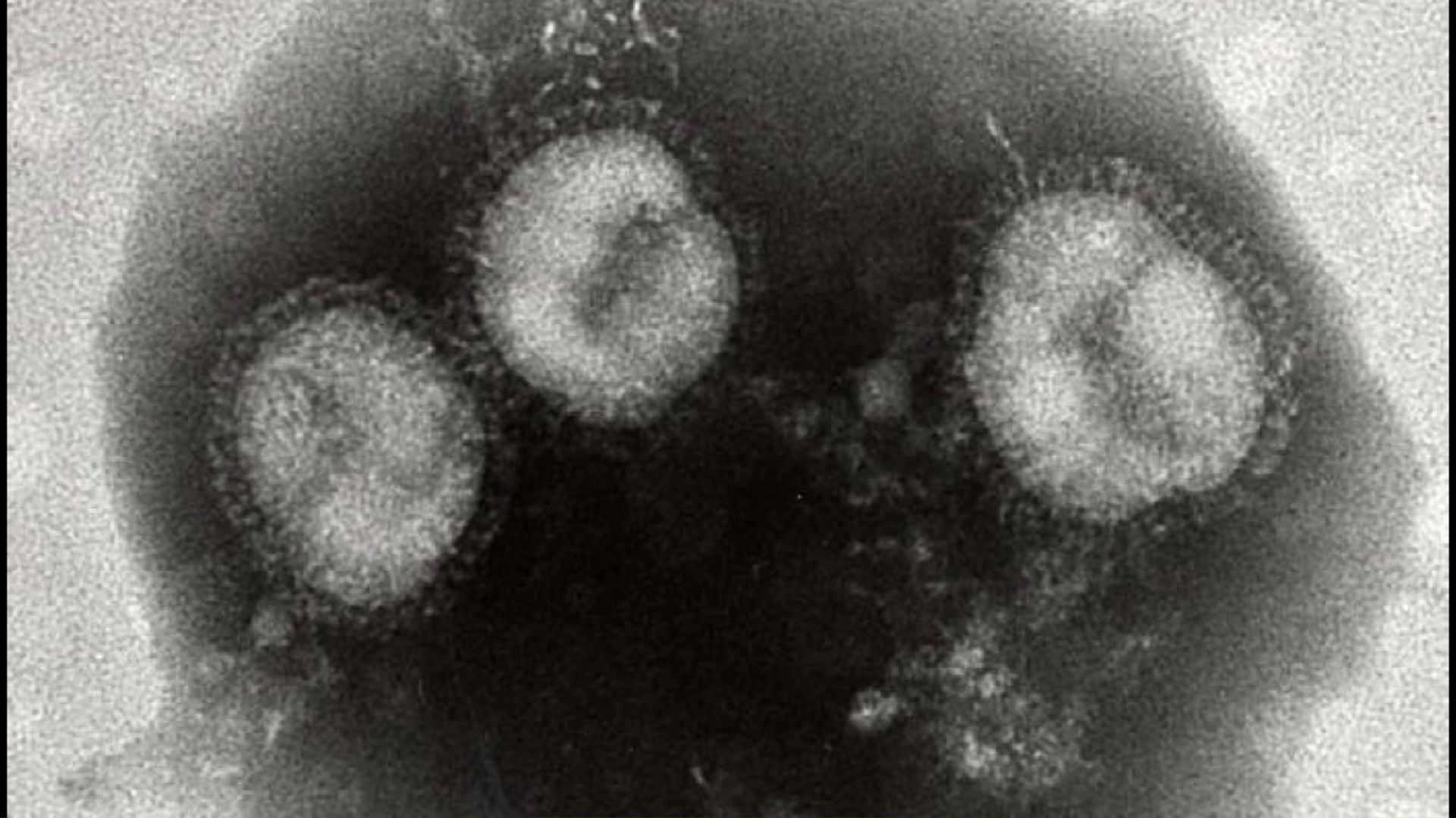 インフルエンザウイルス（提供：札幌市衛生研究所）