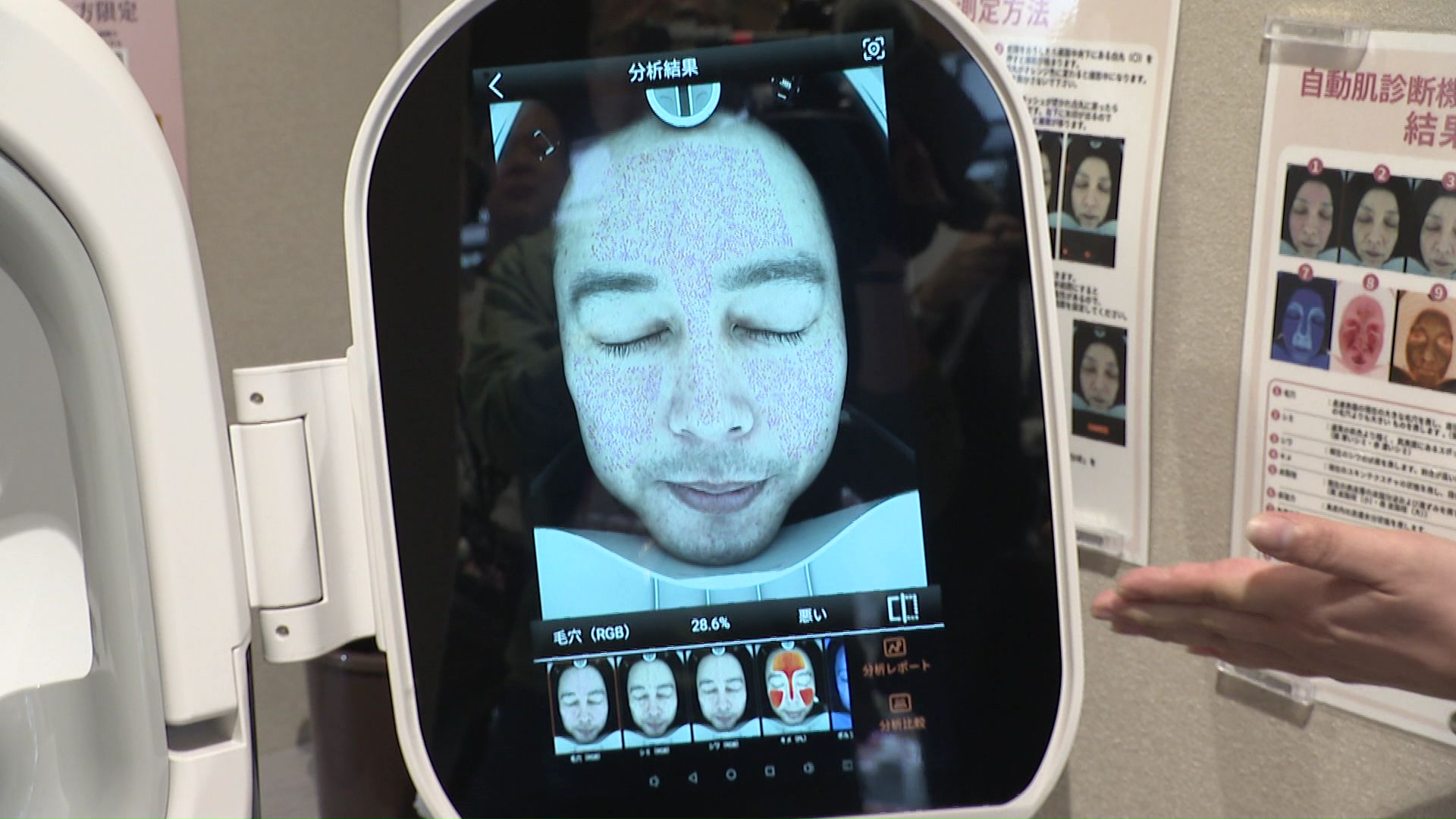 八木フィールドキャスターの肌は…